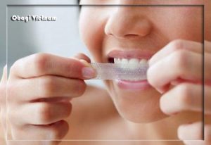 Tẩy trắng răng hiệu quả